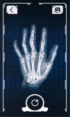 抖音和猫咪合照x光特效相机软件图1