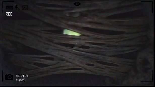 水蛭恐惧症游戏图1