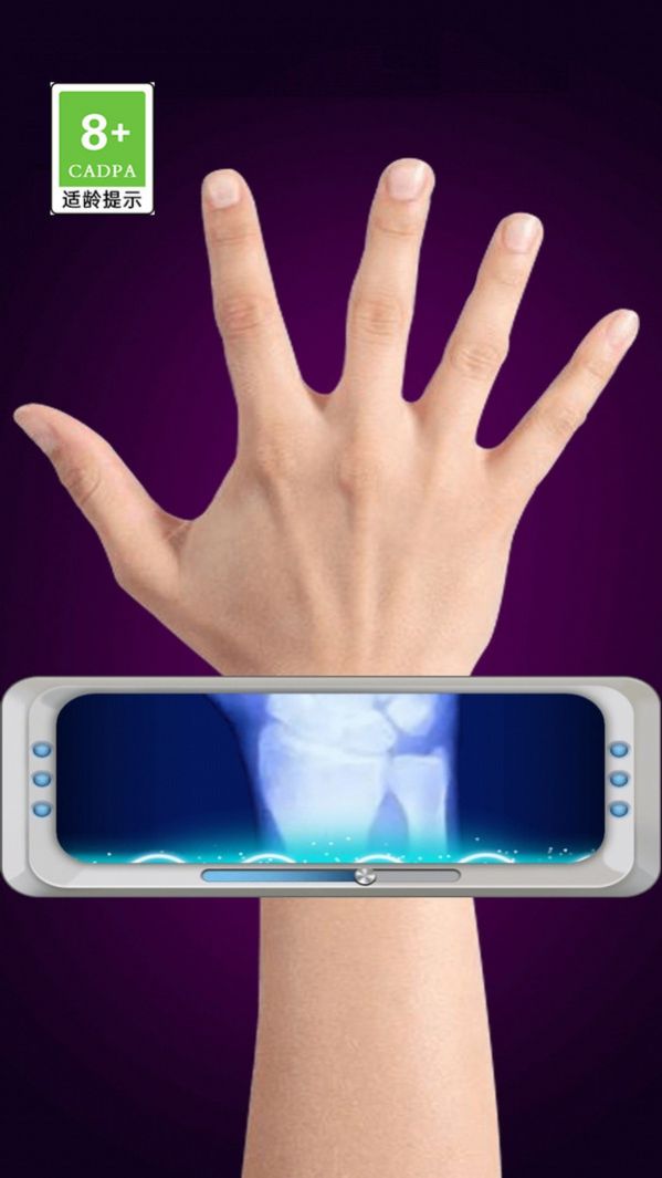模拟X射线最新安卓版图3