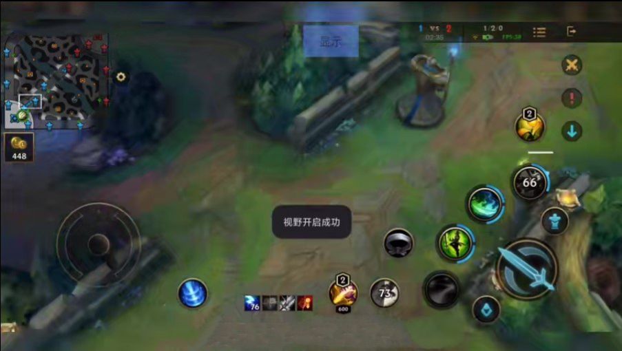 维他命lol手游插件透视软件免费版  v2.4.0.4727图3