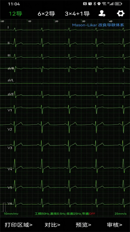 心电一张网手机版图2