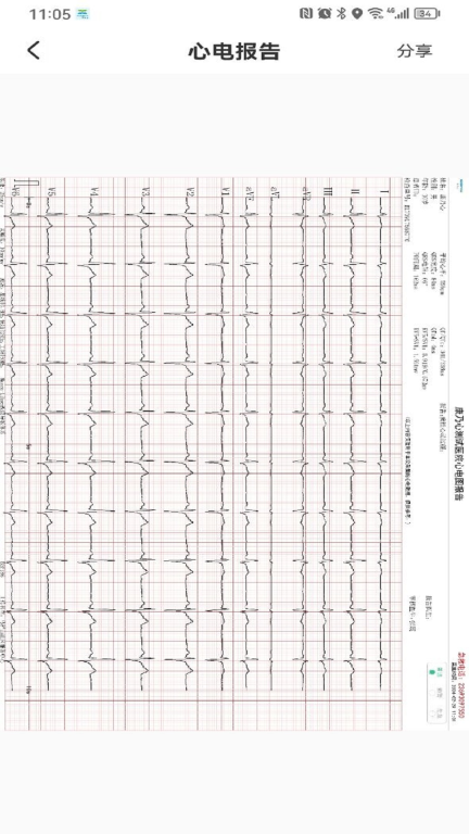 心电一张网手机版图4