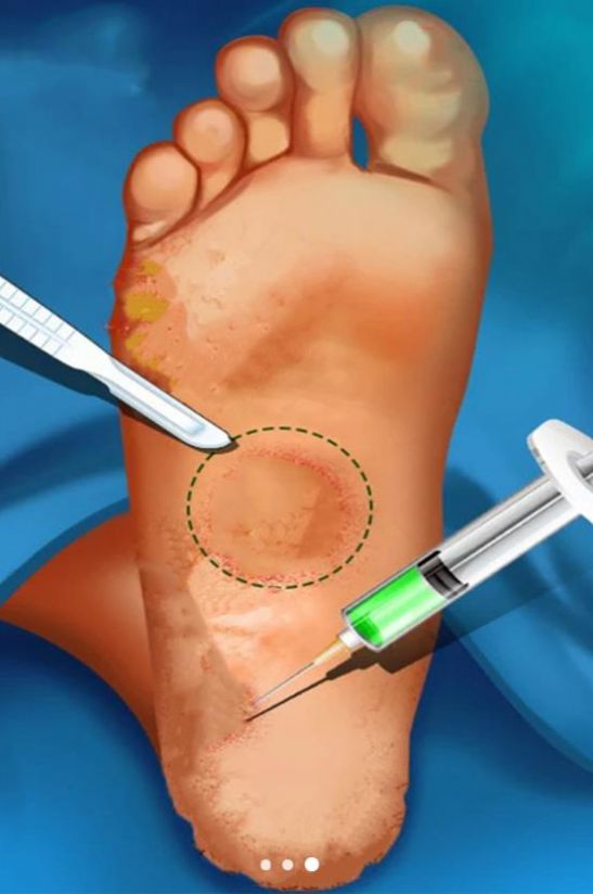 解压修脚模拟器最新版游戏 v1.0图1