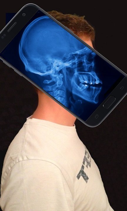 x射线身体扫描模拟器官方图1