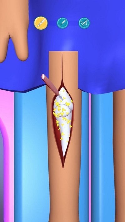 外科手术大师3D中文最新版  v1.14图2