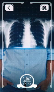 抖音和猫咪合照x光特效相机软件图2