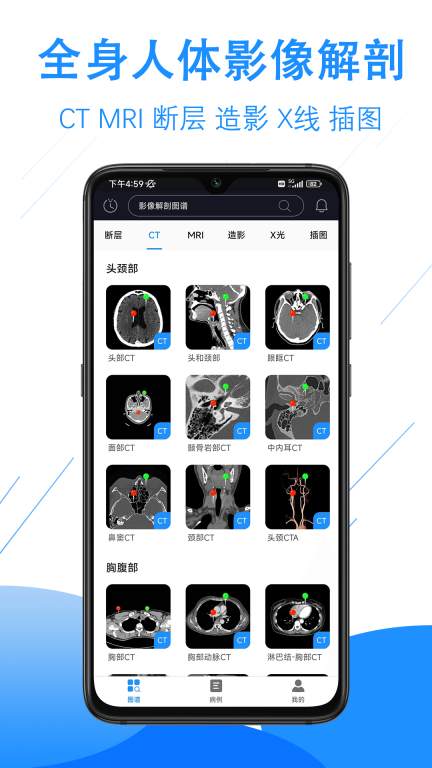 影像解剖图谱图1