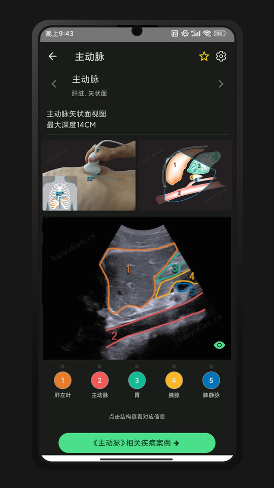 超声智学官方版图2