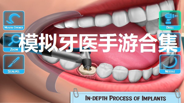 模拟牙医手游合集