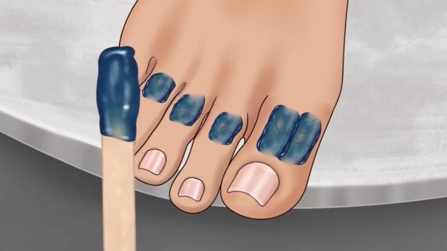 修脚足疔模拟器游戏手机版  v1.0图2