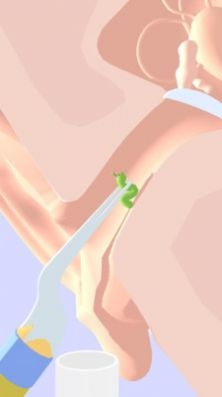 挖耳朵模拟器图3