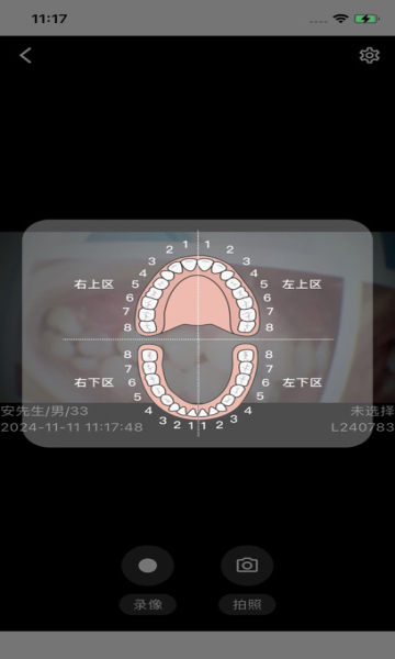 慧视健康口腔观察仪图2
