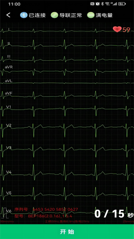 心电一张网手机版图1