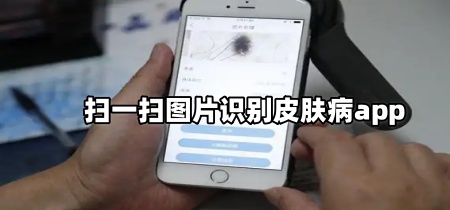 扫一扫图片识别皮肤病app